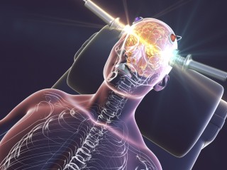 Visszatérhet-e a depresszió rémisztő terápiája, az elektrosokk?