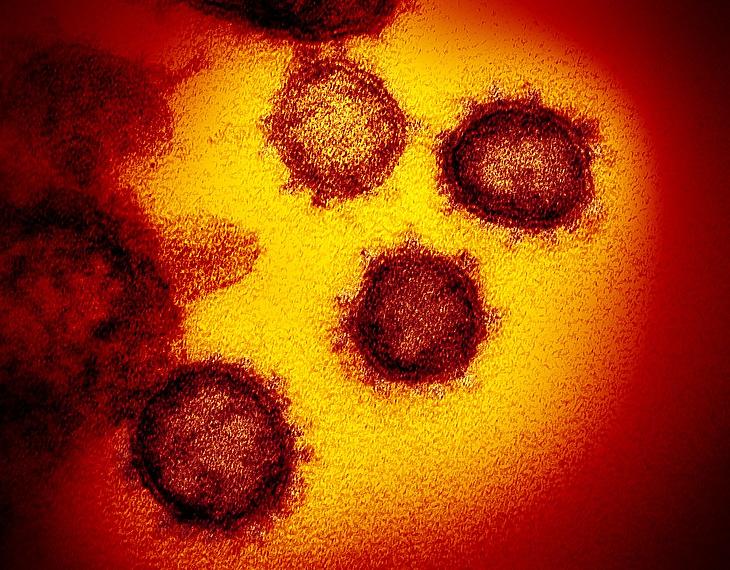 A SARS-CoV-2 humán koronavírus pásztázó elektronmikroszkópos képe. (NIAID - https://www.flickr.com)