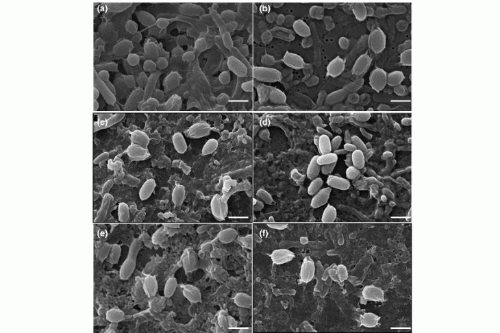 A C. difficile egyes törzsei hipóoldattal való kezelés előtt és után (balra és jobbra). A mennyiség csökken, de a megmaradó baktériumok sértetlennek látszanak mikroszkóp alatt. Fotó: Microbiology Society