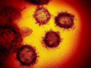 37 éves férfi halt bele a koronavírusba