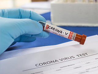Érkezik a 45 perces, sőt a 15 perces koronavírus-teszt