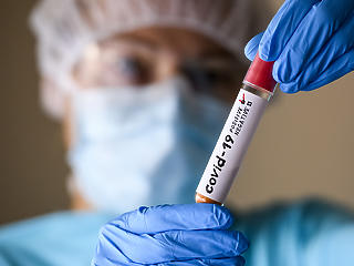 „Tévhit, hogy minél súlyosabb a Covid-fertőzés, annál védettebbé válunk” – mondja Dr. Csilek András infektológus