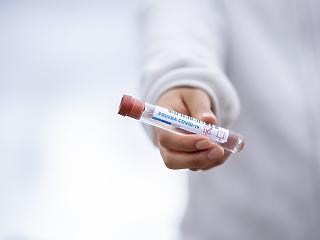 Oroszországban már a második koronavírus elleni védőoltás bejegyzésére készülnek 