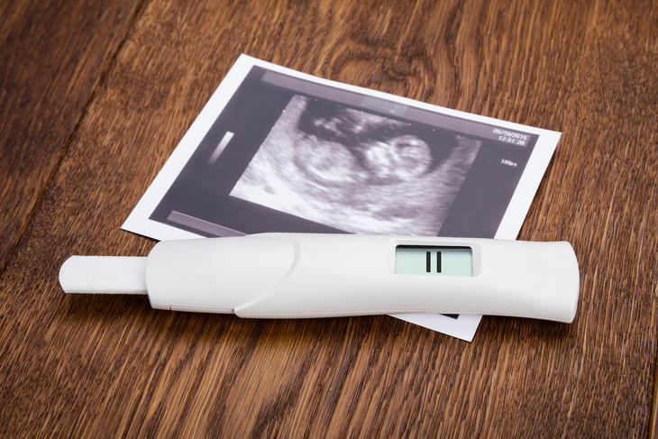 Egy pozitív terhességi teszt mindenkinek mást jelent. Fotó: Depositphotos