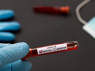 Kéthavi csúcsra ugrott az új koronavírus-fertőzöttek száma az USA-ban