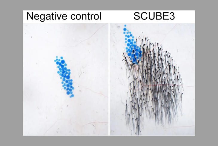 SCUBE3 fehérje hatására beindult szőrnövekedés egy egérkísérlet során (jobbra). A bal oldalon a kontrollfehérje eredménye látható. Fotó: Maksim Plikus lab, University of California Irvine