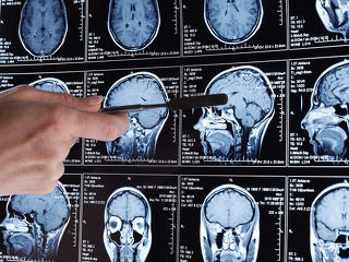 HÉTVÉGÉRE: Az apaság megváltoztatja a férfiak agyát – MRI-vizsgálat bizonyította be