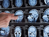 Az apaság megváltoztatja a férfiak agyát – MRI-vizsgálat bizonyította be